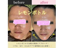 ココスタイルビューティー(COCOSTYLE beauty)の雰囲気(レモンボトルで変わる★もたつき顔にレモンボトルでスッキリ)