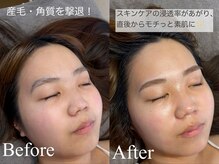 エヌワクシング バイナツ(N-Waxing bynatsu)