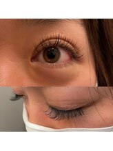 スパークジョイ(SPARK JOY)/フラットラッシュ140本