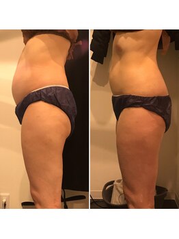 ファビリス 天王寺店(FAVILIS)/オーダーボディ5回/50代