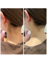 ブリリアント(Brilliant)/うなじスッキリ