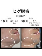 アールブイ 館林店(RV)/1ヶ月で変わります！