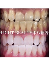 ライトビューティー 本八幡店(LIGHT BEAUTY)/最初が変わりずらい方も！