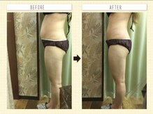 ビューティー ボディ スラ(Beauty body)/キャビテーション効果抜群です