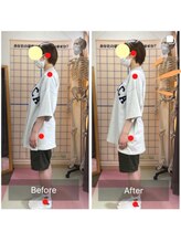 コアスタイル(Core×Style)/【姿勢矯正】Before → After