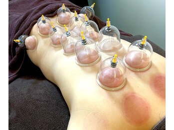 癒し処 くるり/カッピング！！