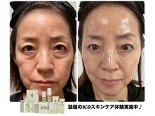 韓国肌管理スキンケアのICDインセルダム取扱開始しました♪