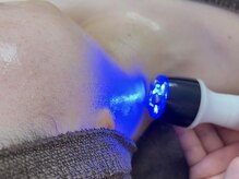 アーニャビューティー(Anya Beauty)/大人気の小顔ハイパーナイフ☆