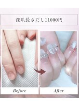 ハッピービューティー(Happy Beauty)/深爪長さだし☆11000円