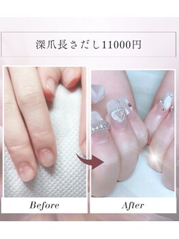 深爪長さだし☆11000円