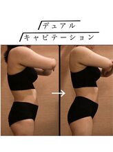 マイン イオンモール浜松市野店/ 【トリプル効果★キャビ痩身】