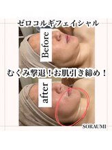 ソラウミ(SORAUMI)/むくみ・二重あご撃退！