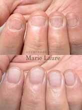 マリーロール 淀屋橋本店(Marie Laure)/自爪育成/深爪矯正/ネイルケア