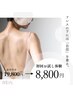 お顔と背中のセット割引がお得な全身コース！◆夏前に全身つるすべ美肌♪