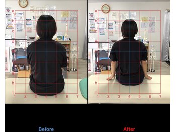 ストレチックス 近江八幡店/姿勢改善ビフォーアフター1回