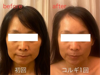 ビーキュート 神戸元町店(BE-CUTE)/コルギ1回