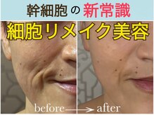 リコロン 銀座(Re:)