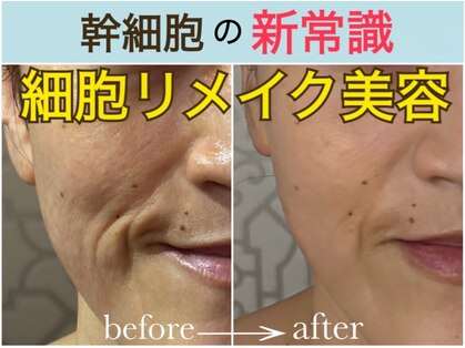 リコロン 銀座(Re:)の写真