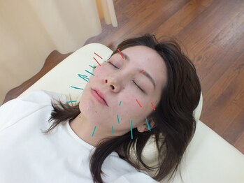 さくら鍼灸整骨院の写真/【美容鍼/鍼灸/経絡施術などほぼ全メニュー4000円以下】最新機器を多数ご用意しており、通いやすさも◎