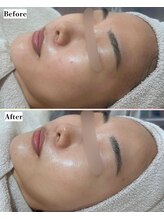 ソワナ(soina)/【神楽坂駅/フェイシャル/毛穴】