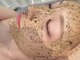モア 星ヶ丘店(MORE)の写真/毛穴の開き・黒ずみ・開きを改善したい方必見◎ハーブピーリングで毛穴の汚れを除去し、憧れのうる艶肌へ♪