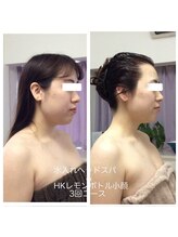 ラヴィソンファム(Ravissant femme)/レモンボトル＆水入れヘッドスパ