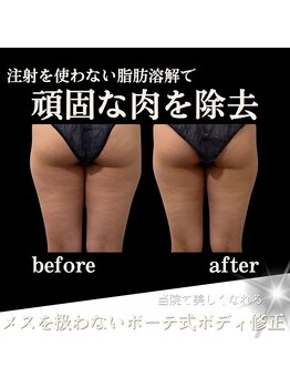 クリニカルボーテ 心斎橋院(CLINICAL BEAUTE)/足を出すのが楽しくなる！