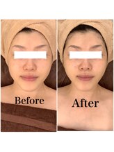 スペチアーレ 夙川/美顔革命