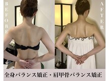 ソウ バイ ソウ(So by 蒼)/激変5回。ブライダルエステ整体