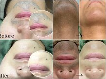 メンズサロンエヌエー(MEN'S SALON NA)