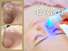 ベルネ(BELLUNE)