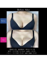 レクリエイター(Re:QREATOR)/セルフエステ(before after)