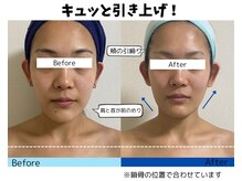 お顔の研究所/ビフォーアフター写真♪