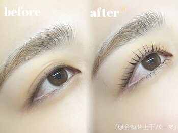 シェリル(Cherilu)/before/after