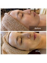 ラクレア(LA KULEA)/韓国人気Ｎ０１艶肌　ララピール