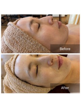 ラクレア(LA KULEA)/韓国人気Ｎ０１艶肌　ララピール