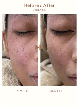 ルポ(Repos)/レディースエステシェービング