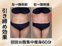 イヨヨ(iyoyo)/【痩身】Before After