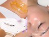 《VIOセット》VIOトリプル脱毛&フェイシャルワックス全顔 23,100円→18,000円
