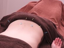 ハリプラス(HariPlus)の雰囲気（【整体×鍼灸】慢性的不調・肩こり腰痛・生理の悩みを根本改善！）