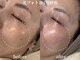 ヌー バイ エクラビューティー 早良区(Nu by Eclat beauty)の写真