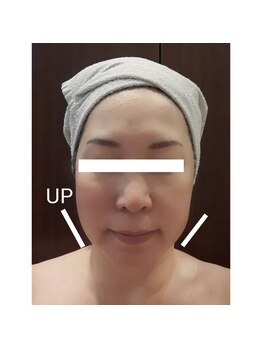 ファイン 水戸店(Fine)/カッサマッサージ