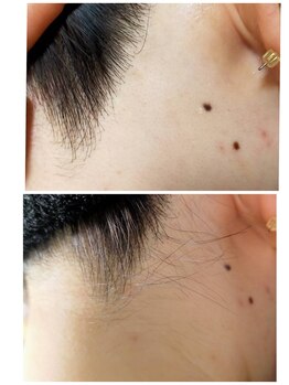 エン(en.)/BeforeAfter写真42