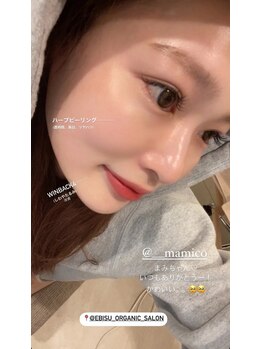 アンバー 恵比寿(AMBER)/二重あご改善/輪郭デザイン