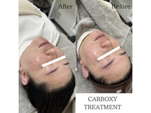 ラ フルール(La Fleur)/カーボキシートリートメント