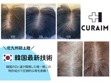 トータルビューティー ソラン(Soran)の雰囲気（本気で育毛促進！！まずは頭皮診断とカウンセリングへ）