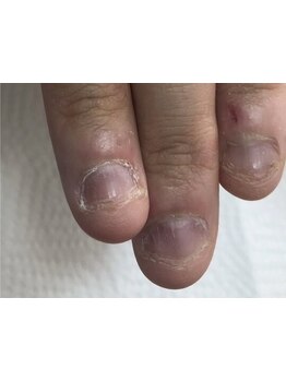 爪の悩みを解消できる（ケア含む）