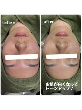 クラリ(Clari)/毛穴/ハイドロジェリーマスク