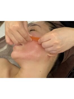 小顔になりたい