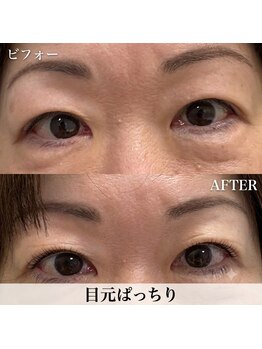 ラカン ビューティーアンドスキン(Lacan beauty&skin)の写真/モチの良いまつ毛パーマやLEDエクステが人気◎眉毛WAXで自然な眉毛を目指すリピート必須のサロン!
